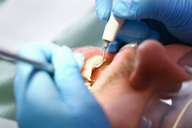 Best Cracked Tooth Emergency Dentist  in Ham Lake, MN