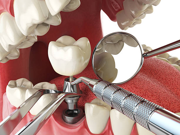Best Emergency Gum Pain Relief  in Ham Lake, MN