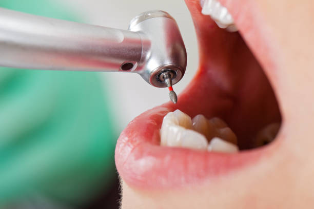 Best Tooth Pain Emergency Relief  in Ham Lake, MN